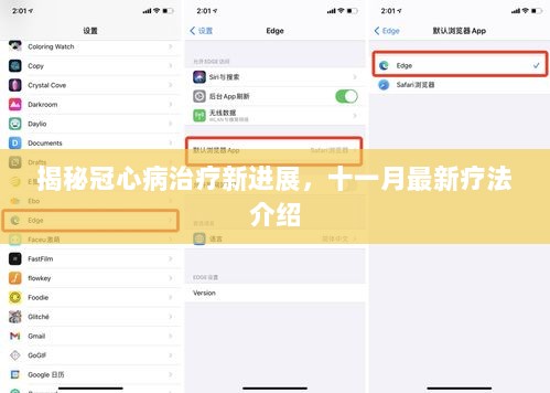 揭秘冠心病治疗新进展，十一月最新疗法介绍