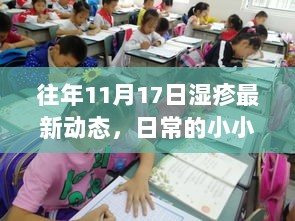 往年11月17日湿疹最新动态，日常的小小胜利之路