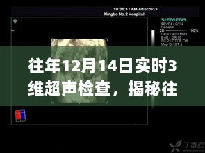 揭秘往年12月14日实时三维超声检查，科技引领医学诊断新纪元