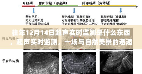 往年12月14日超声实时监测，与自然美景的邂逅之旅