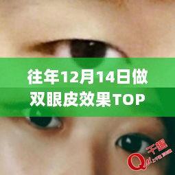 科技重塑魅力双眼，独家双眼皮效果TOP实时奇致，引领生活新风尚！