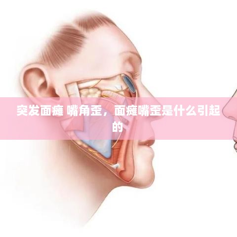 突发面瘫 嘴角歪，面瘫嘴歪是什么引起的 