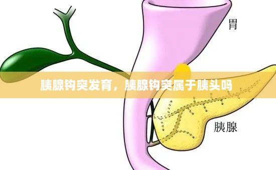 胰腺钩突发育，胰腺钩突属于胰头吗 