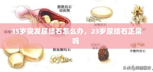 35岁突发尿结石怎么办，23岁尿结石正常吗 